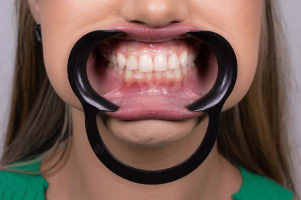 Retractor Frontal Expandex - Rosado - Adulto Autoclavable - 1 Unidad Indusbello - Imagen 3