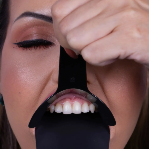 Retractor Oclusal Modelo "Mf" Negro - Tamaño Adulto - 1 Unidad Indusbello - Imagen 3