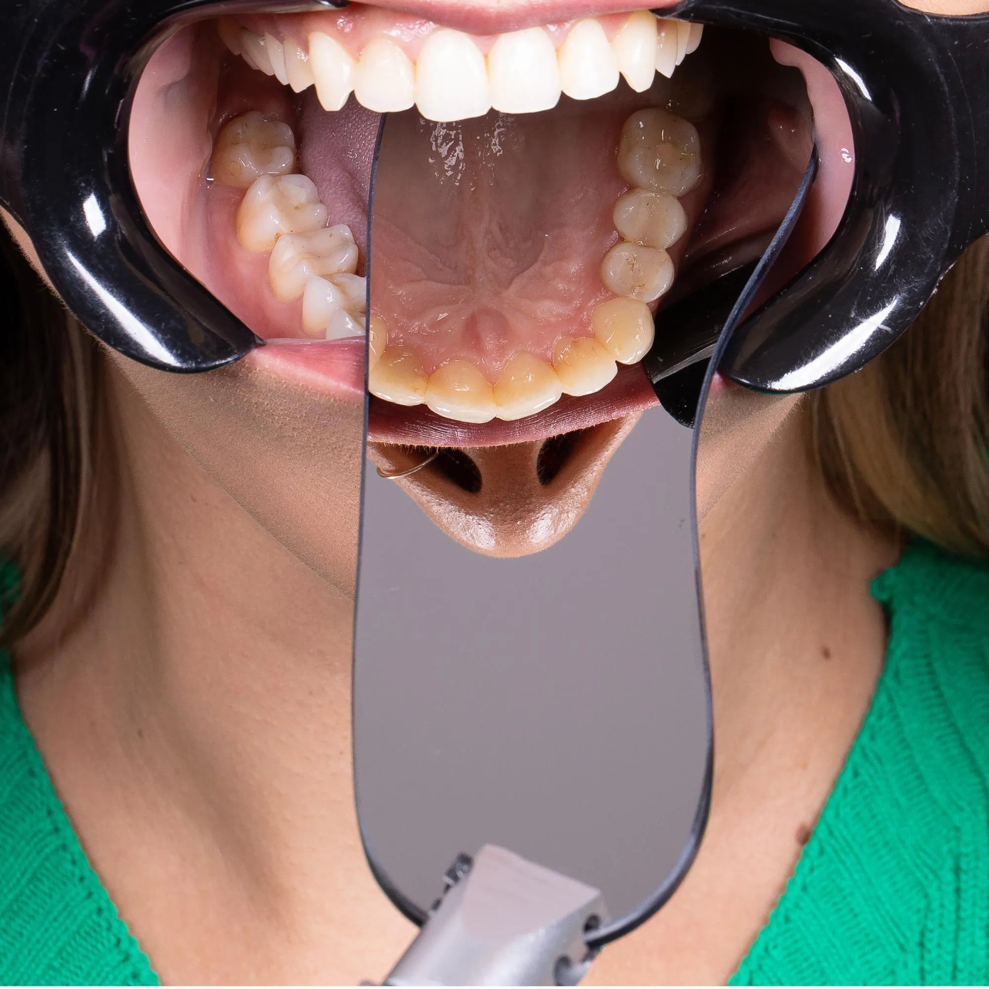 Espejo Intraoral Indusbello IB 01 - Imagen 2