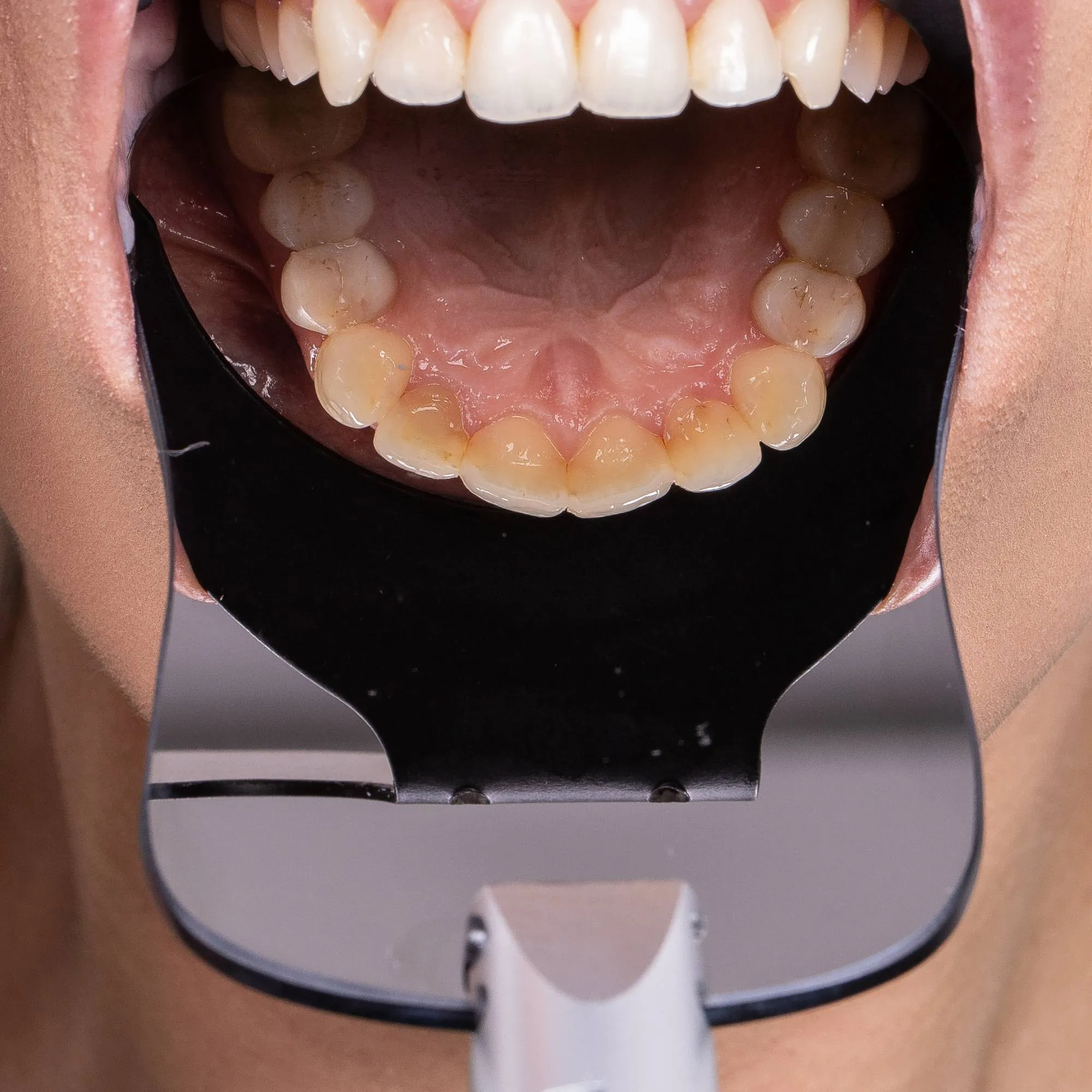 Espejo Intraoral Indusbello IB 04 - Imagen 2